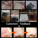 Removedor de Cravos Ultrassônico